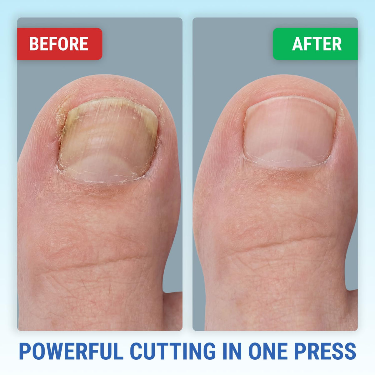 KLIPP toenail clippers next to other foot care tools