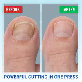 KLIPP toenail clippers next to other foot care tools