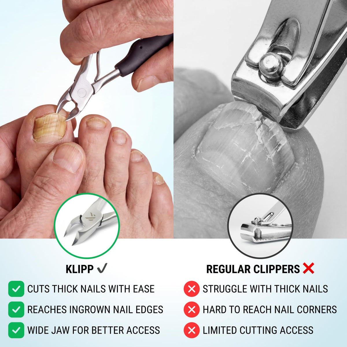 KLIPP toenail clippers showing the curved blade design