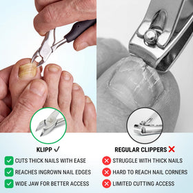 KLIPP toenail clippers showing the curved blade design