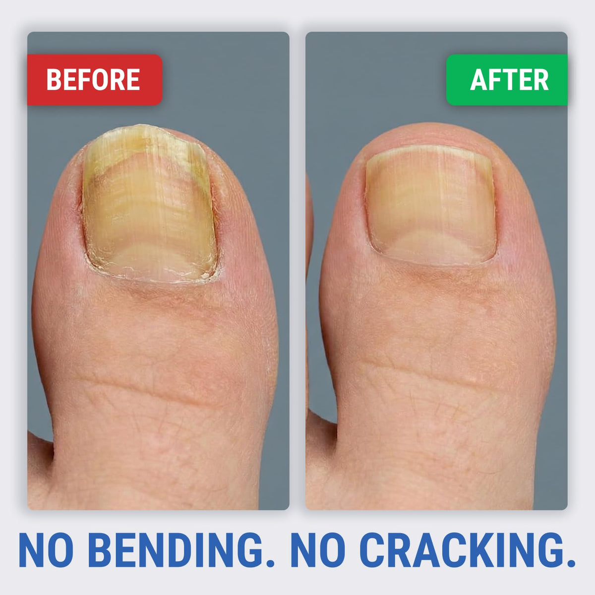 KLIPP Toenail Clippers with a measuring tape for size