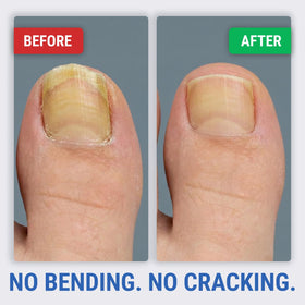 KLIPP Toenail Clippers with a measuring tape for size