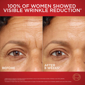 L'Oreal Paris Revitalift Triple Power Face Moisturizer application on skin