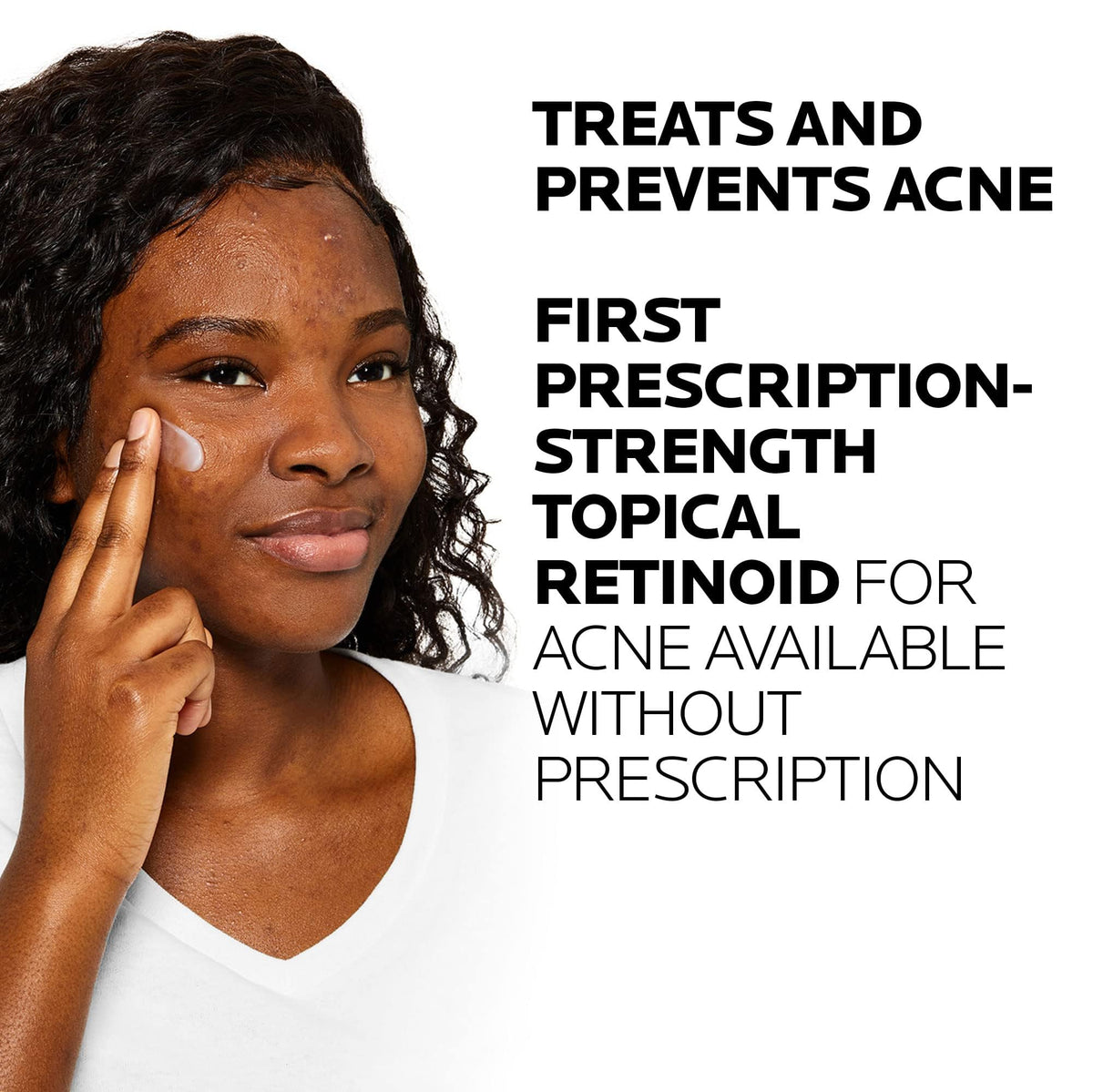La Roche-Posay Effaclar Adapalene Gel 0.1% texture close-up