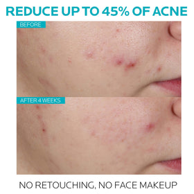 La Roche-Posay Effaclar Serum bottle side view