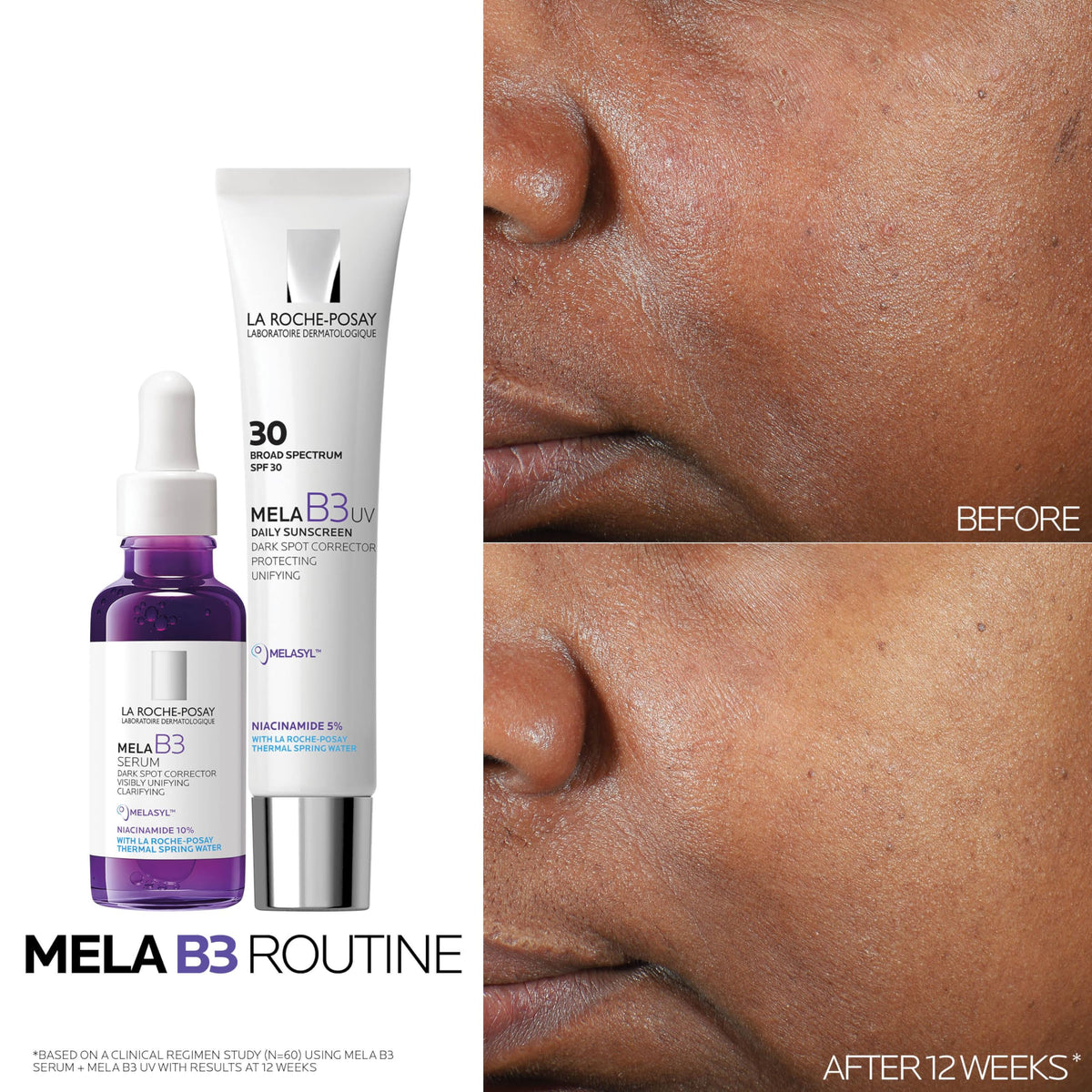 La Roche-Posay Mela B3 Dark Spot Serum texture on hand