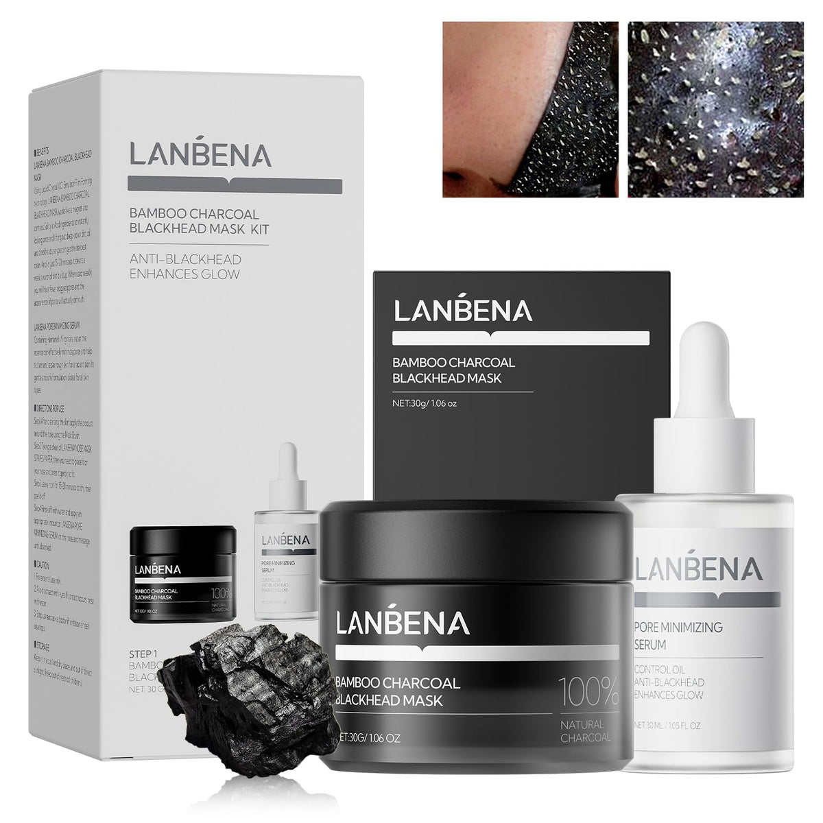 LANBENA 3-in-1 Blackhead Removal Set including pore strips and serum