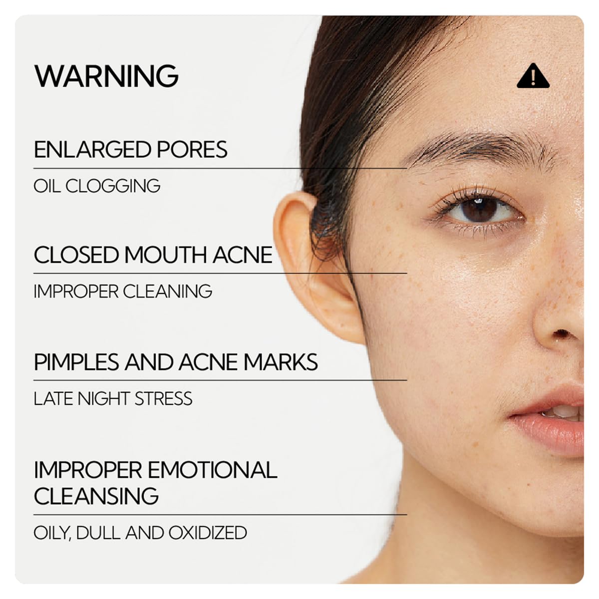 LANBENA Blackhead Remover Pore Strips on a bathroom counter