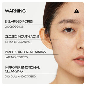 LANBENA Blackhead Remover Pore Strips on a bathroom counter