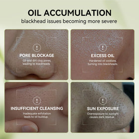 LANBENA Pore Minimizing Serum bottle with measurement markings