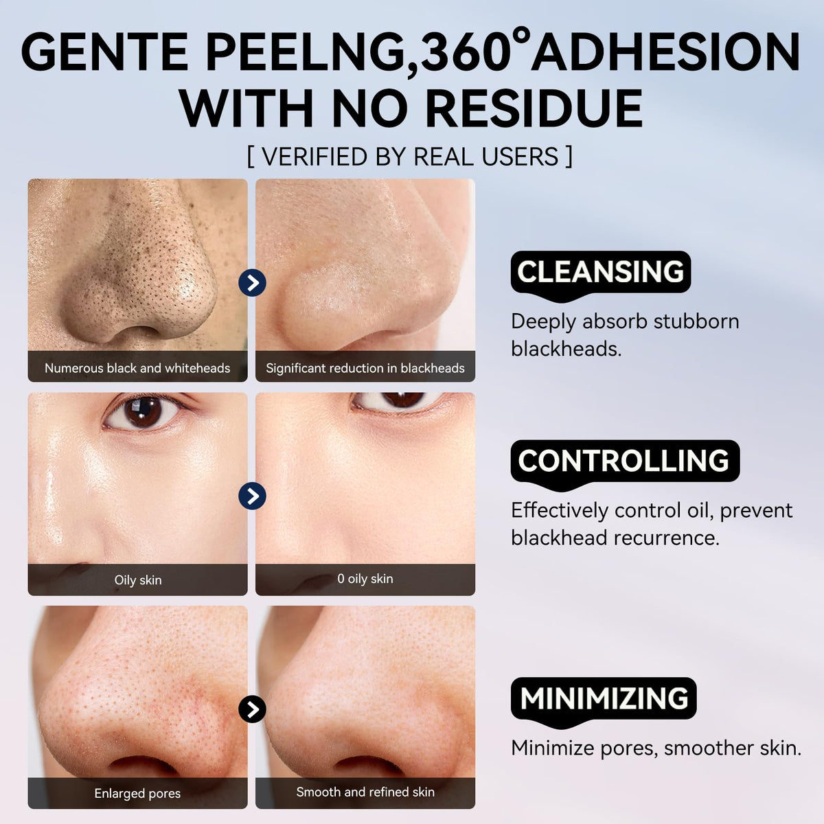 LANBENA removal papers for blackhead care