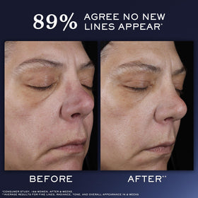 Lancôme Génifique Ultimate Recovery Serum side view with packaging