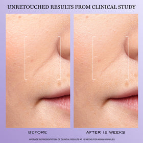 Lancôme Rénergie H.C.F. Triple Serum 20ml packaging