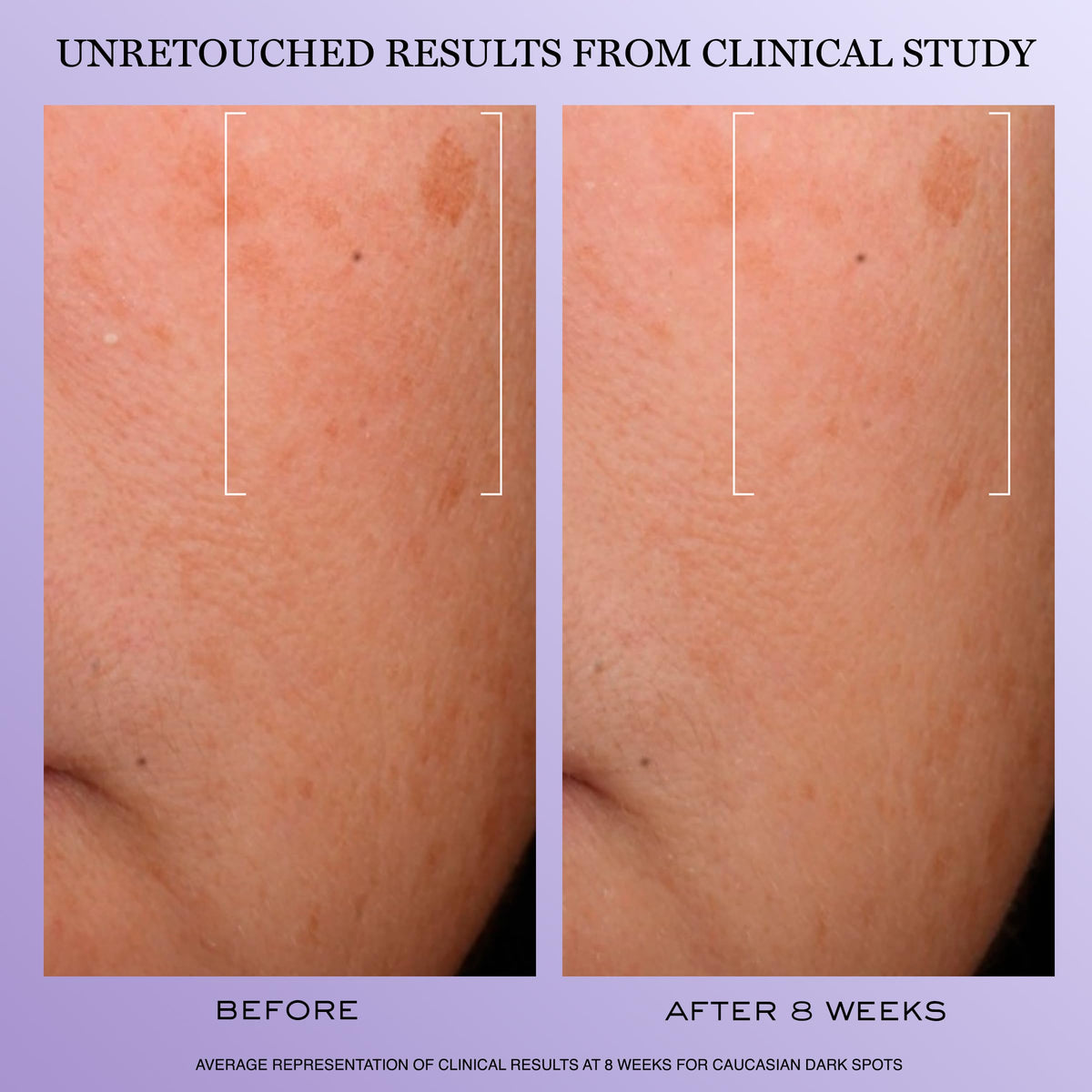 Lancôme Rénergie H.C.F. Triple Serum application on hand