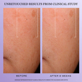 Lancôme Rénergie H.C.F. Triple Serum application on hand