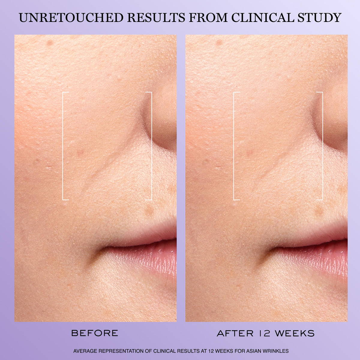 Lancôme Rénergie H.C.F. Triple Serum texture on skin
