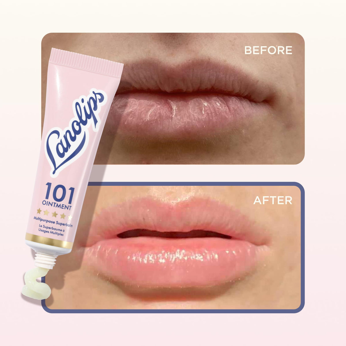 Lanolips 101 Multipurpose Ointment Duo with natural ingredients