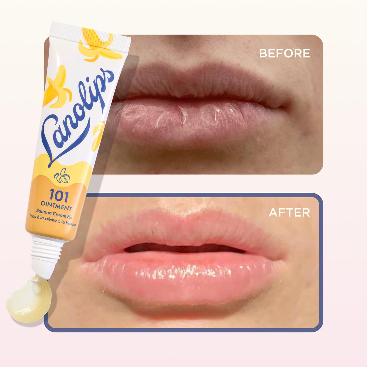 Lanolips 101 Ointment Banana Cream Pie on cuticles