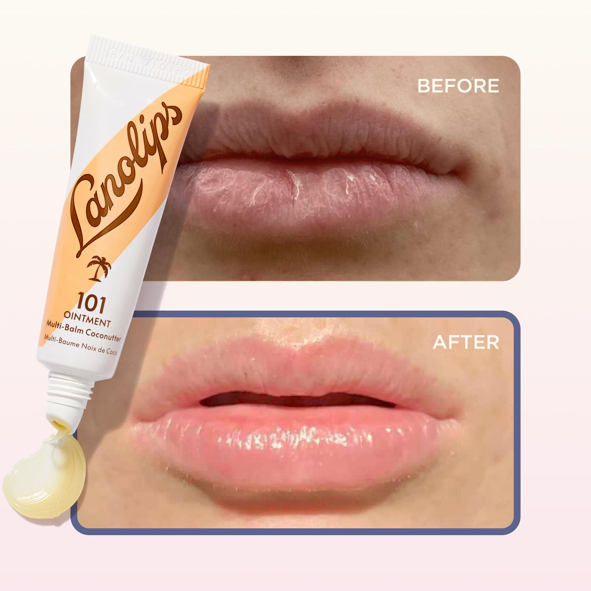 Lanolips 101 Ointment close-up of ingredients