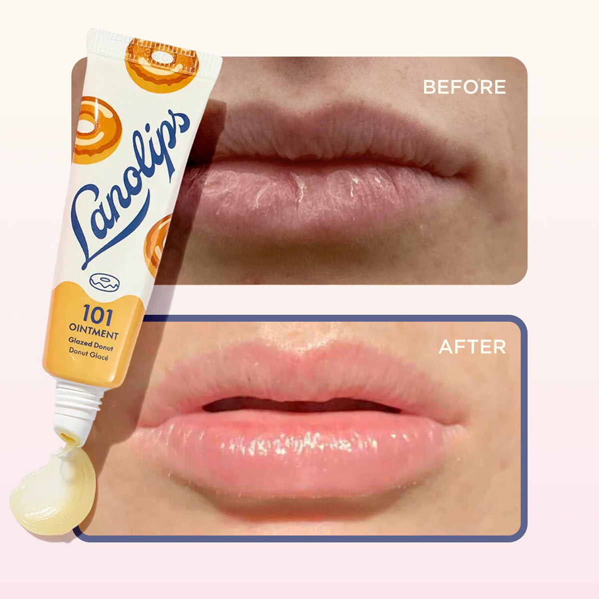 Lanolips 101 Ointment Glazed Donut in hand