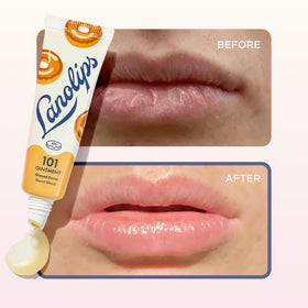 Lanolips 101 Ointment Glazed Donut in hand