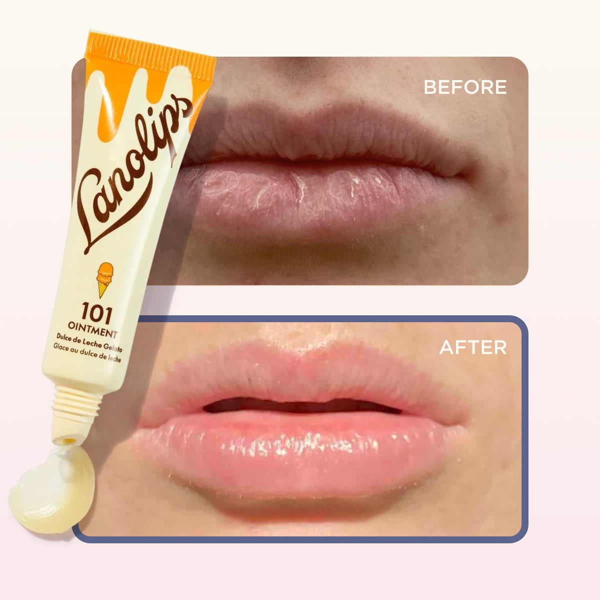 Lanolips 101 Ointment on cuticles