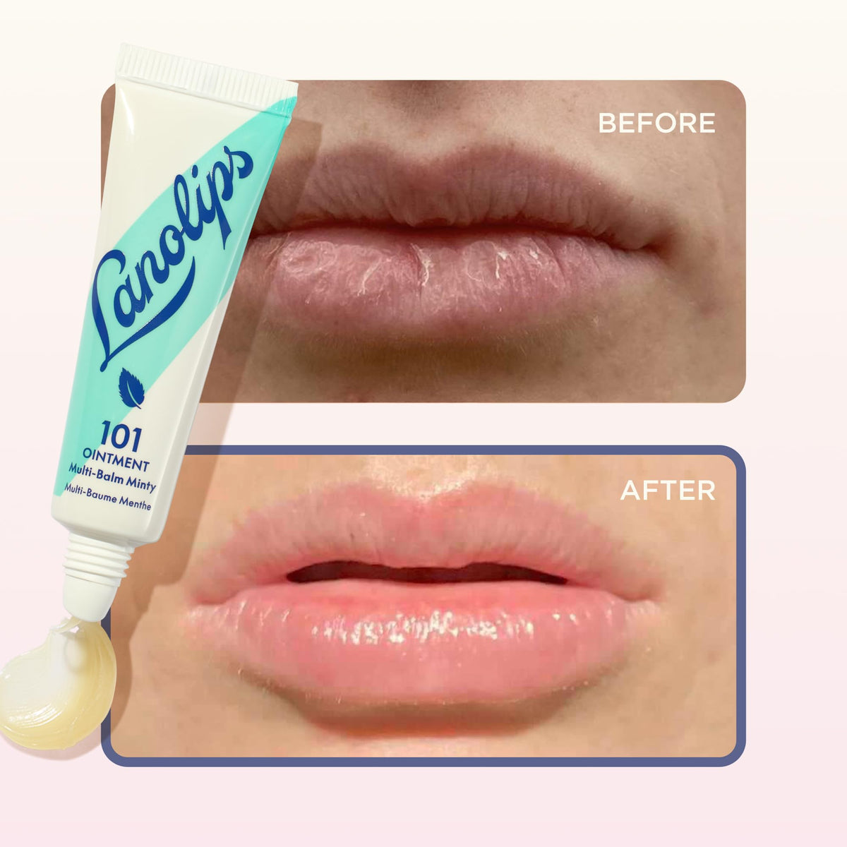 Lanolips 101 Ointment on cuticles