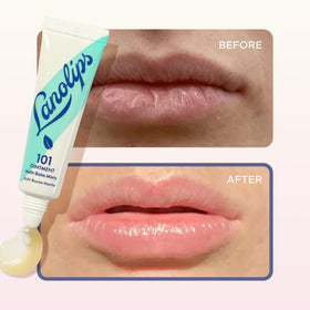 Lanolips 101 Ointment on cuticles