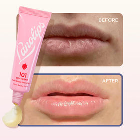 Lanolips 101 Ointment Strawberry on cuticles