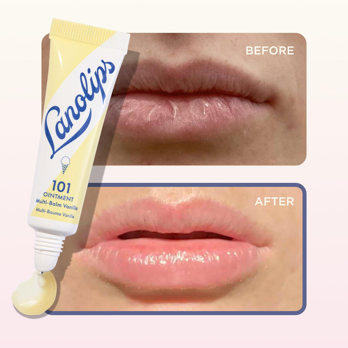 Lanolips 101 Ointment Vanilla packaging front