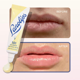 Lanolips 101 Ointment Vanilla packaging front