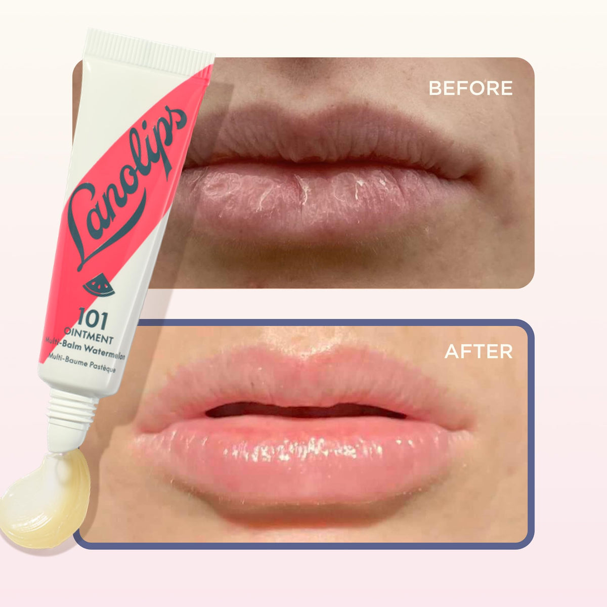 Lanolips 101 Ointment Watermelon lifestyle scene