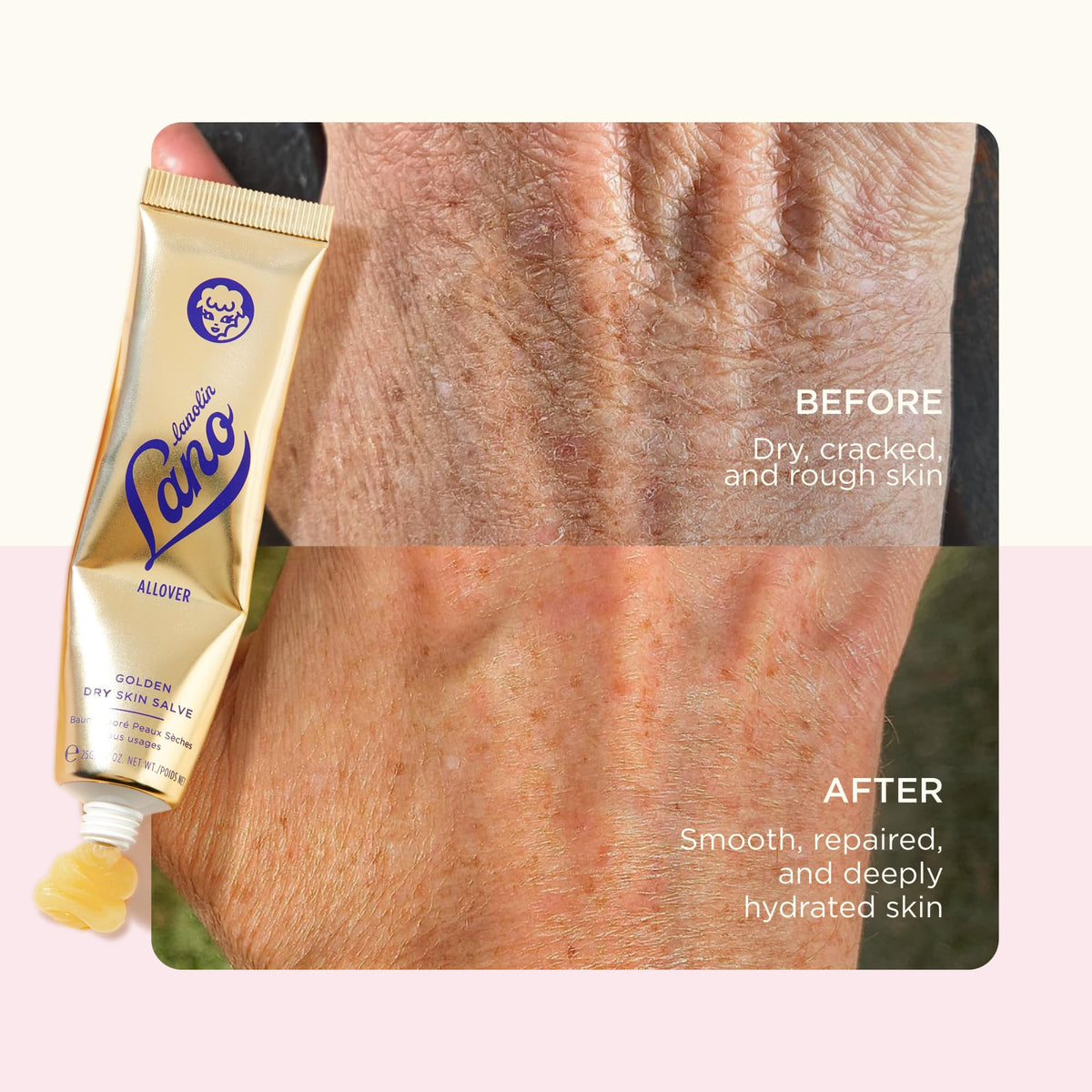 Lanolips Golden Dry Skin Salve 25g close-up of the salve texture
