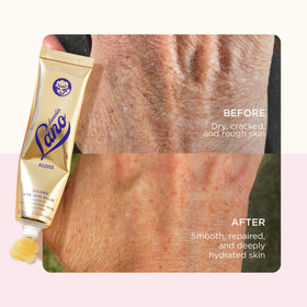 Lanolips Golden Dry Skin Salve 25g close-up of the salve texture