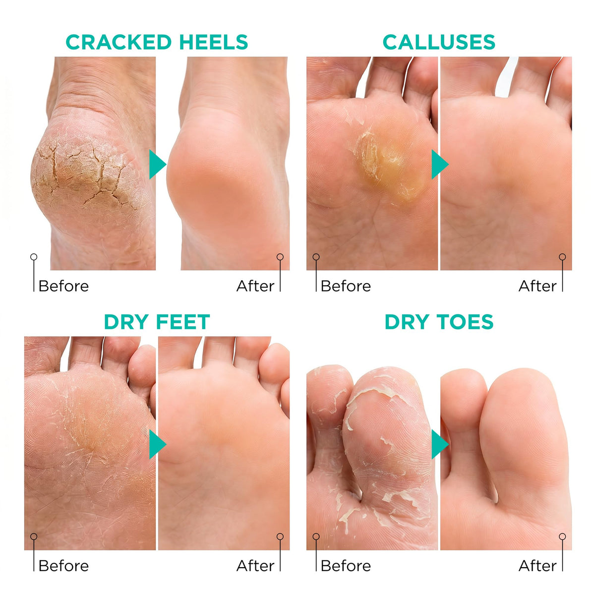 Lavinso Foot Peeling Mask application process