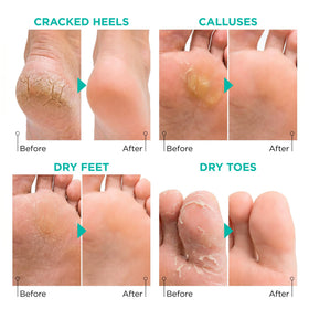 Lavinso Foot Peeling Mask application process
