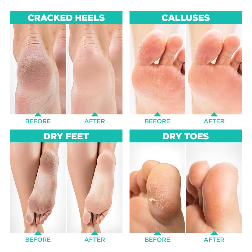 Lavinso Foot Peeling Mask application process