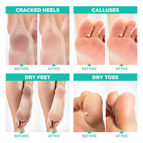 Lavinso Foot Peeling Mask application process