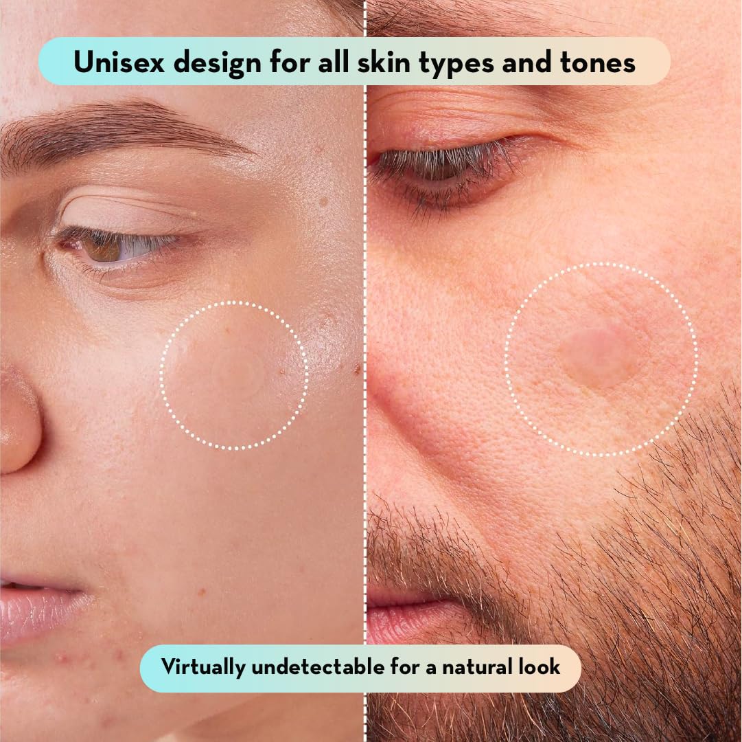 LE GUSHE Korean Pimple Patches with a makeup setup
