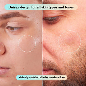 LE GUSHE Korean Pimple Patches with a makeup setup