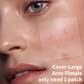Lifestyle image of Daolyo Pimple Patches in use