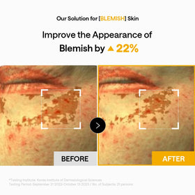 Lifestyle image of using MEDIHEAL under eye patches