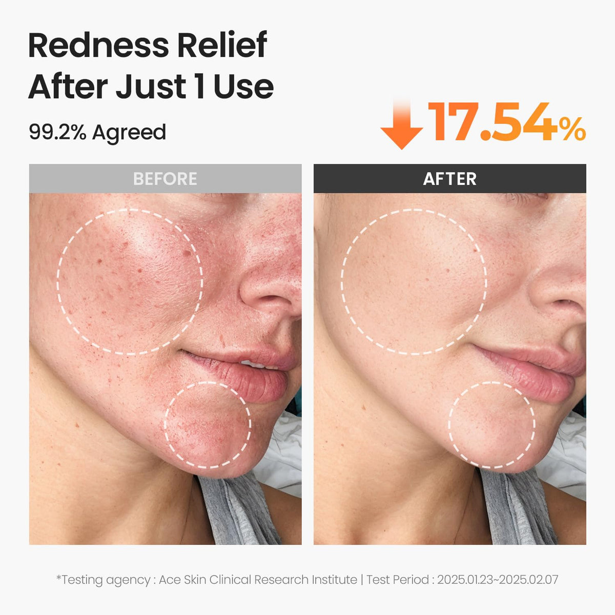 Lifestyle scene with SKINFOOD Carrot Carotene Toner Pads in use