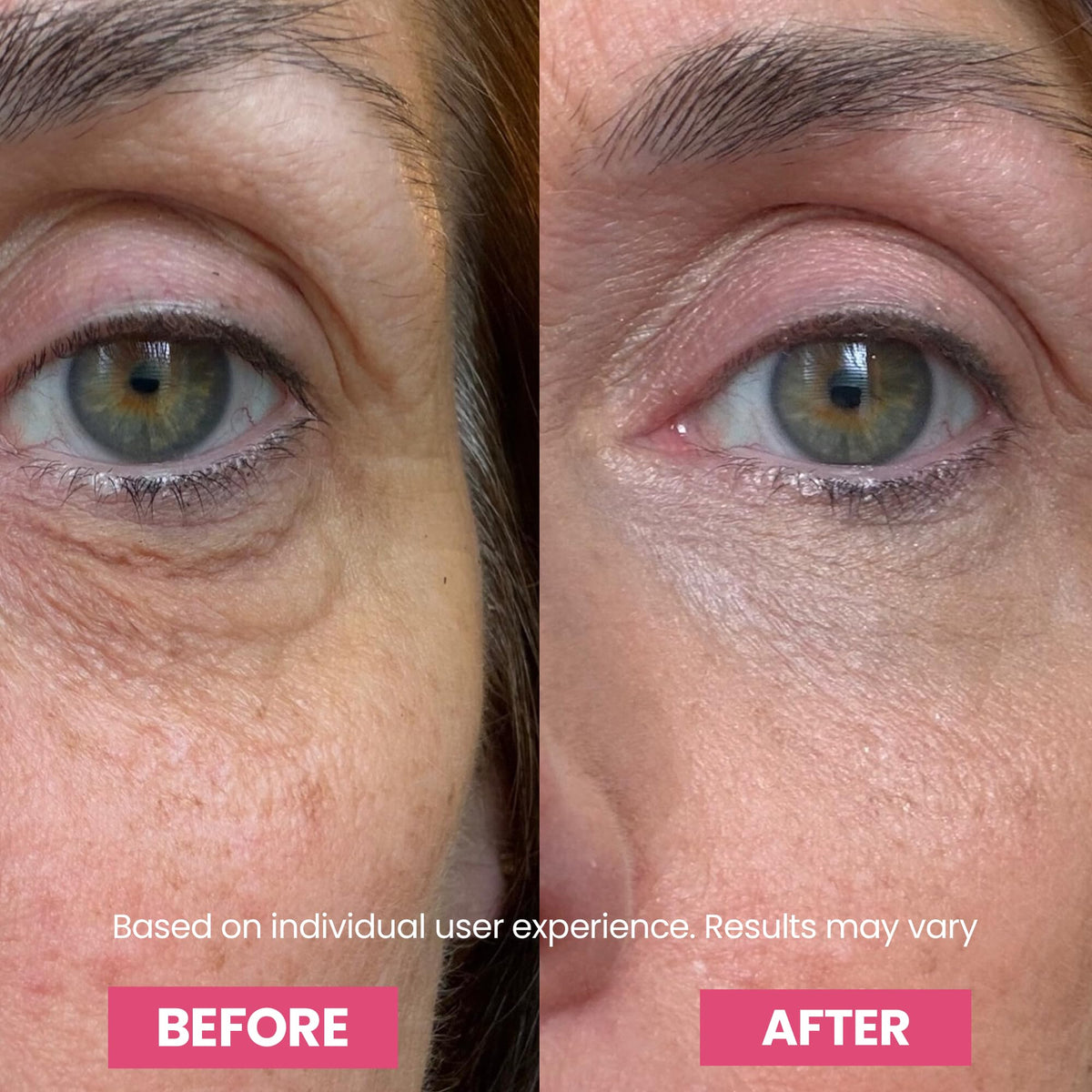 Lifestyle shot of Luxe Korean Under Eye Balm