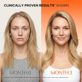 lilyeve GROWTURN Hair Growth Serum application on scalp
