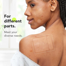 LitBear Large Pimple Patches 12mm size close-up
