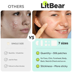 LitBear Large Pimple Patches 20x60mm size close-up