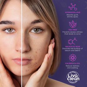LivaClean patches in use on a model's face for blemish control