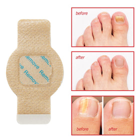 LTQXGT Toenail Care Patches showing self-adhesive design