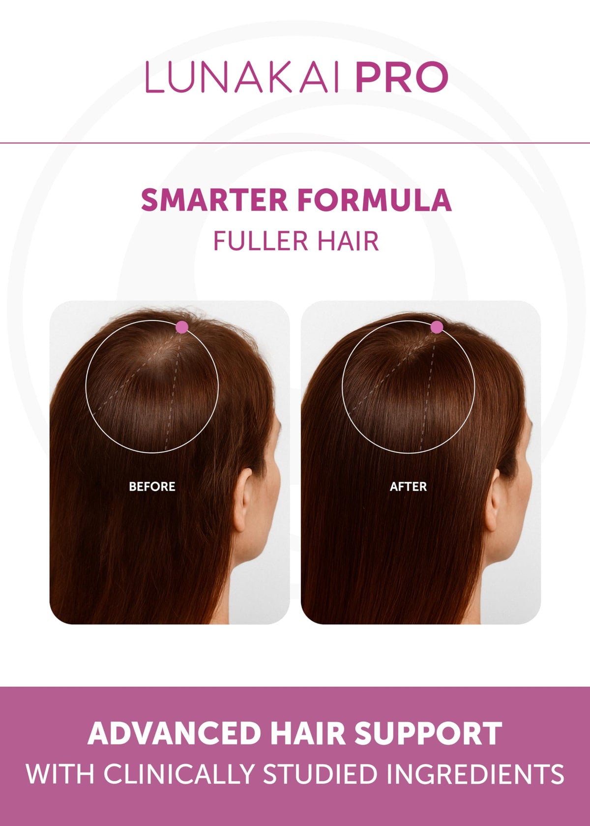 Lunakai Hair Growth Supplement capsules on a wooden surface